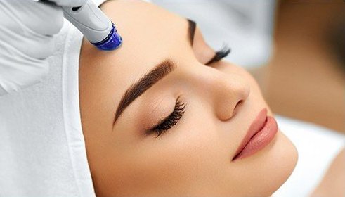 black Friday London Laser, London , Ontario