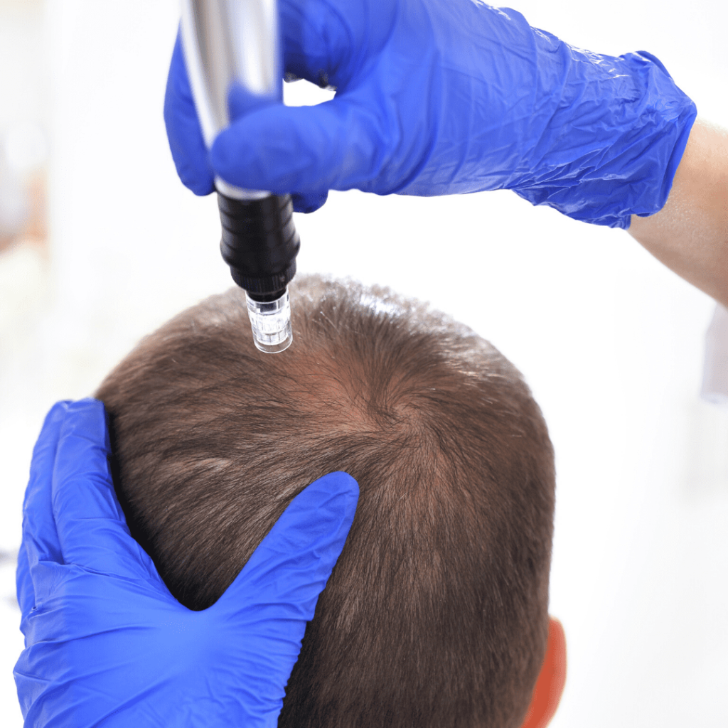 CIT Hair Regrowth