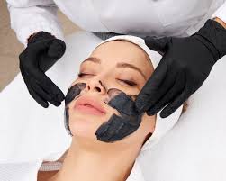 Carbon Laser Peel